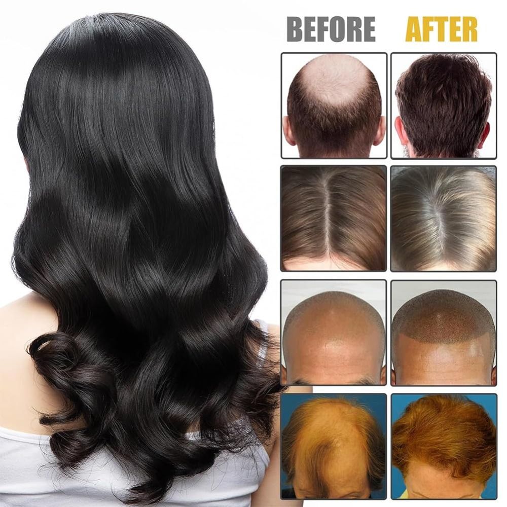 Novo Conjunto de Escovas Vorte - Hair Care Formulation avaliação e preço