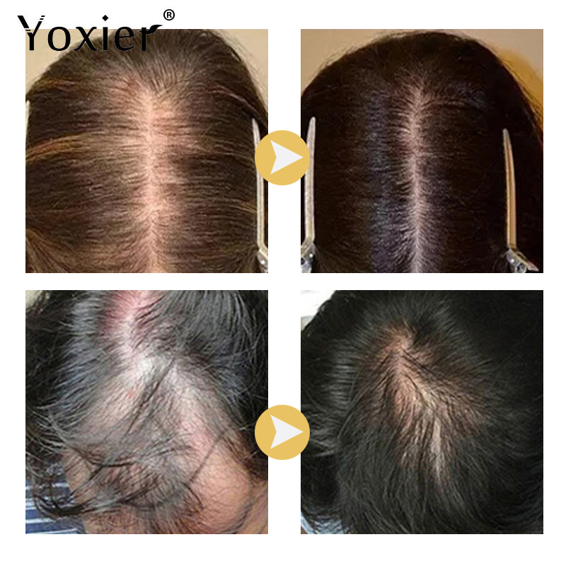 Soro de crescimento intensivo  - Hair Care Treatment avaliação e preço